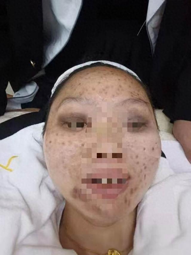 呗”贷款办卡后美容店跑路；警方回应：嫌疑人死亡撤案了尊龙凯时app平台女子被“免